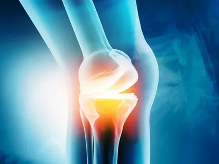 Things you should know about knee replacement surgery